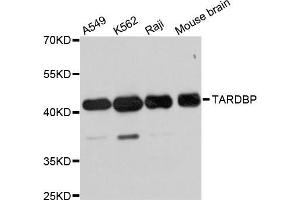 Western blot analysis of extracts of various cell lines, using TARDBP antibody (ABIN5999467) at 1/1000 dilution. (TARDBP 抗体)