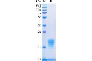 Human IL5 Protein, His Tag on SDS-PAGE under reducing condition. (IL-5 Protein (His tag))