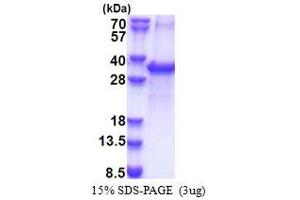 SDS-PAGE (SDS) image for Acyl-CoA Thioesterase 11 (ACOT11) (AA 19-250) protein (His tag) (ABIN5853381) (ACOT11 Protein (AA 19-250) (His tag))