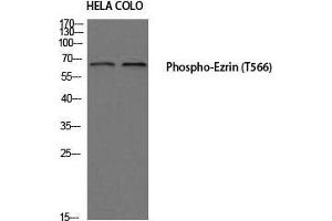 Western Blot (WB) analysis of HeLa COLO205 using Phospho-Ezrin (T566) antibody. (Ezrin 抗体  (pThr566))