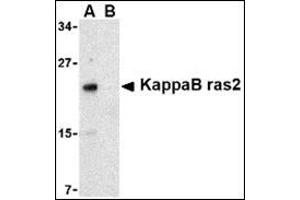 Western blot analysis of KappaB ras2 in RAW264. (NKIRAS2 抗体  (C-Term))