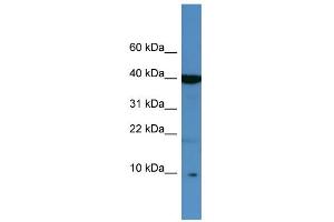 Western Blotting (WB) image for anti-serine Peptidase Inhibitor, Kazal Type 6 (SPINK6) (Middle Region) antibody (ABIN2786464)