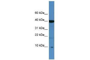 WB Suggested Anti-SPINK6 Antibody Titration: 0. (SPINK6 抗体  (Middle Region))