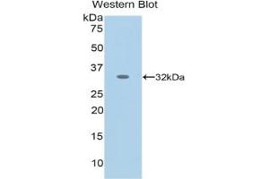 Detection of Recombinant NES, Human using Monoclonal Antibody to Nestin (NES) (Nestin 抗体  (AA 178-399))