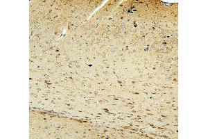 IHC analysis of FACL4/ACSL4 using anti-FACL4/ACSL4 antibody (ABIN7602756).