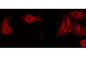 ABIN6275655 staining 293 by IF/ICC. (USP38 抗体  (Internal Region))
