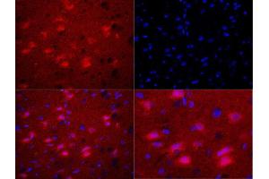 Immunofluorescence (Paraffin-embedded Sections) (IF (p)) image for anti-BCL2-Associated X Protein (BAX) (pSer184) antibody (ABIN682843)
