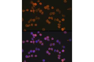 Immunofluorescence analysis of THP-1 cells using //IB Rabbit mAb (9776) at dilution of 1:100 (40x lens). (Iba1 抗体)