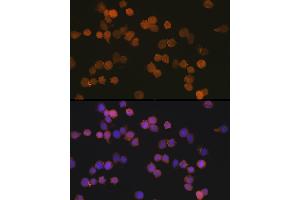 Immunofluorescence analysis of THP-1 cells using //IB Rabbit mAb (9776) at dilution of 1:100 (40x lens). (Iba1 抗体)