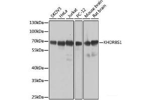 Western blot analysis of extracts of various cell lines using KHDRBS1 Polyclonal Antibody at dilution of 1:1000. (KHDRBS1 抗体)