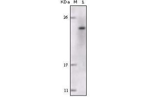 Western blot analysis using FES mouse mAb against truncated FES recombinant protein. (FES 抗体)