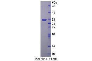 SDS-PAGE analysis of Human ABAT Protein. (ABAT 蛋白)