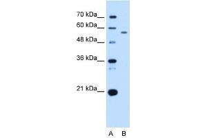 Western Blot showing UBXD2 antibody used at a concentration of 2. (UBXD2 抗体  (Middle Region))