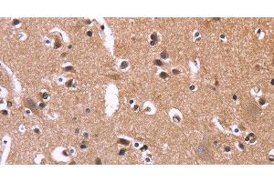 Immunohistochemistry of paraffin-embedded Human brain tissue using SELPLG Polyclonal Antibody at dilution 1:50 (SELPLG 抗体)