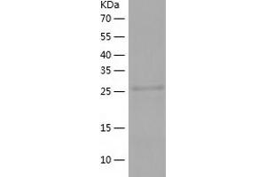 HERPUD1 Protein (AA 1-263) (His tag)