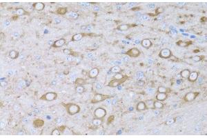Immunohistochemistry of paraffin-embedded Mouse brain using MYH10 Polyclonal Antibody at dilution of 1:100 (40x lens). (MYH10 抗体)