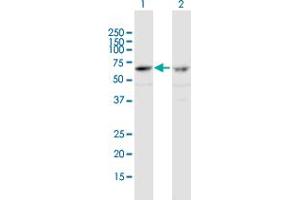 Western Blot analysis of ZNF284 expression in transfected 293T cell line by ZNF284 MaxPab polyclonal antibody. (ZNF284 抗体  (AA 1-593))