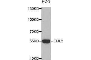 Western blot analysis of extracts of PC-3 cells, using EML2 antibody (ABIN5972622). (EML2 抗体)