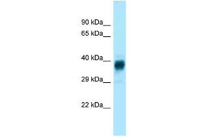 WB Suggested Anti-Olfr329-ps Antibody Titration: 1. (OLFR329-PS 抗体  (Middle Region))