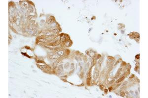 Immunohistochemistry (IHC) image for anti-Stratifin (SFN) (AA 198-248) antibody (ABIN7448925) (14-3-3 sigma/SFN 抗体  (AA 198-248))