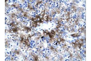 Image no. 1 for anti-Protein Inhibitor of Activated STAT, 3 (PIAS3) (AA 548-597) antibody (ABIN202823) (PIAS3 抗体  (AA 548-597))