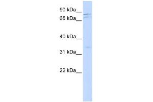 WB Suggested Anti-NEK11 Antibody Titration:  0. (NEK11 抗体  (Middle Region))