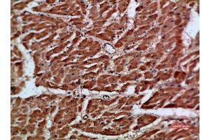 Immunohistochemical analysis of paraffin-embedded human-heart, antibody was diluted at 1:200 (ARTN 抗体  (AA 101-150))