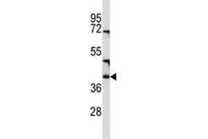 CD1c antibody western blot analysis in NCI-H460 lysate (CD1c 抗体  (AA 226-253))