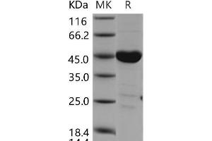 Western Blotting (WB) image for C-Src tyrosine Kinase (CSK) protein (ABIN7320121) (CSK 蛋白)