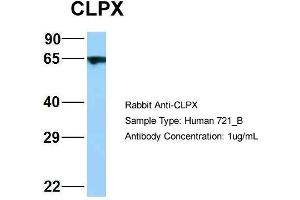 Host: Rabbit Target Name: WT1 Sample Type: 721_B Antibody Dilution: 1. (CLPX 抗体  (C-Term))