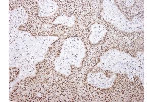 Immunohistochemistry (IHC) image for anti-Elongation Factor Tu GTP Binding Domain Containing 2 (EFTUD2) (AA 1-50) antibody (ABIN7448542)