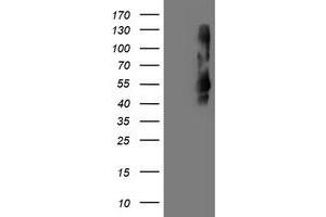 Western Blotting (WB) image for anti-Transmembrane Protein with EGF-Like and Two Follistatin-Like Domains 2 (TMEFF2) antibody (ABIN1501419) (TMEFF2 抗体)