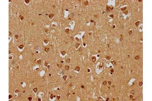 IHC image of ABIN7169769 diluted at 1:400 and staining in paraffin-embedded human brain tissue performed on a Leica BondTM system. (SKOR1 抗体  (AA 744-965))