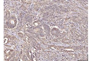 IHC analysis of RANGAP1 using anti-RANGAP1 antibody (ABIN7600225). (RANGAP1 抗体  (AA 165-587))