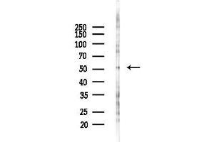 Western blot analysis of lysates from COLO205 cells(starvation 24h treatment), using PROC Antibody at 1/1000 dilution.