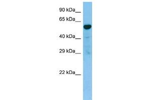 WB Suggested Anti-TACR3 AntibodyTitration: 1. (TACR3 抗体  (C-Term))