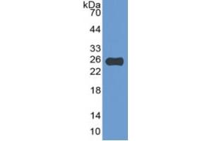 Western Blotting (WB) image for Retinoblastoma 1 (RB1) ELISA Kit (ABIN6574260)