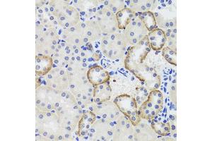 Immunohistochemistry of paraffin-embedded mouse kidney using MTERFD3 antibody. (MTERFD3 抗体)