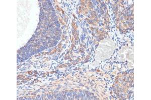 Immunohistochemistry of paraffin-embedded Rat ovary using TES Polyclonal Antibody at dilution of 1:100 (40x lens). (TES 抗体)