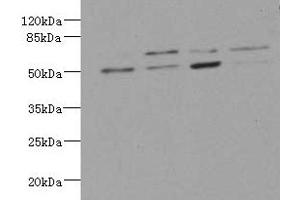 Western blot All lanes: LDB3 antibody at 3. (LIM Domain Binding 3 Protein 抗体  (AA 1-283))