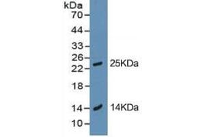 Rabbit Capture antibody from the kit in WB with Positive Control: BXPC-3 cell lysate. (Trypsin ELISA 试剂盒)