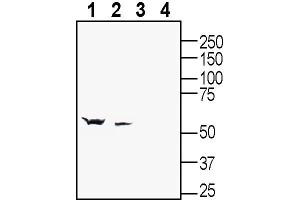 anti-gamma-aminobutyric Acid (GABA) A Receptor, beta 2 (GABRB2) (AA 405-419), (Intracellular) antibody