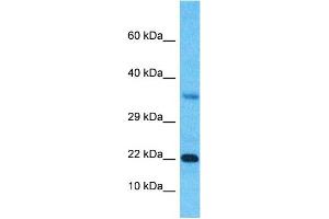 Host:  Rabbit  Target Name:  SSX3  Sample Type:  Fetal Kidney lysates  Antibody Dilution:  1.