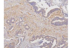 IHC analysis of RAB3GAP2 using anti-RAB3GAP2 antibody (ABIN6719633). (RAB3GAP2 抗体  (AA 1-115))