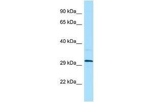 WB Suggested Anti-LILRA5 Antibody Titration: 1. (LILRA5 抗体  (N-Term))