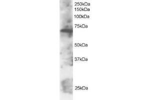 Image no. 1 for anti-SWAP Switching B-Cell Complex 70kDa Subunit (SWAP70) (C-Term) antibody (ABIN374192) (SWAP70 抗体  (C-Term))