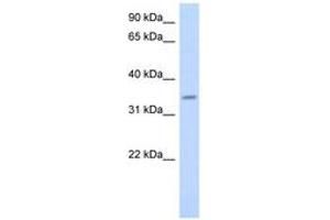 Image no. 1 for anti-Progestin and AdipoQ Receptor Family Member VI (PAQR6) (AA 107-156) antibody (ABIN6743533) (PAQR6 抗体  (AA 107-156))