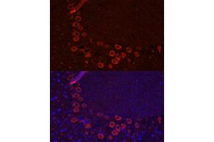 Immunofluorescence (IF) image for anti-Solute Carrier Family 1 (Neuronal/epithelial High Affinity Glutamate Transporter, System Xag), Member 1 (SLC1A1) (AA 430-524) antibody (ABIN6147868)