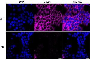 anti-YTH Domain Family, Member 1 (YTHDF1) antibody