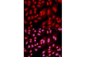 Immunofluorescence analysis of U2OS cell using PPP2R2A antibody. (PPP2R2A 抗体  (AA 1-447))